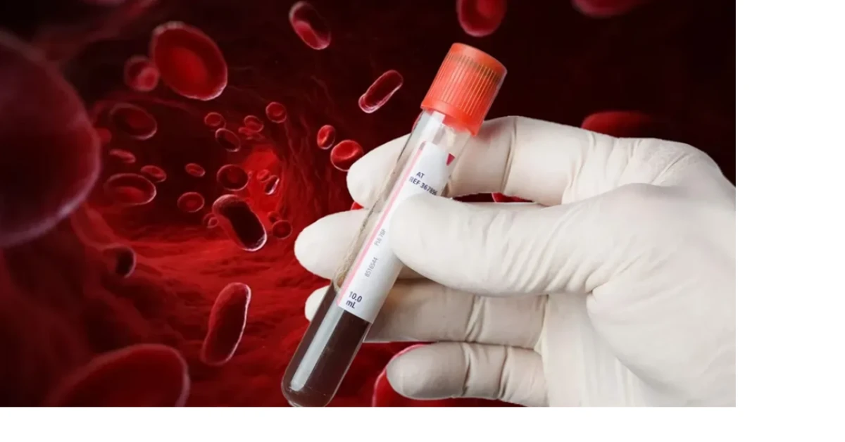 6 milyonda bir rastlanan 