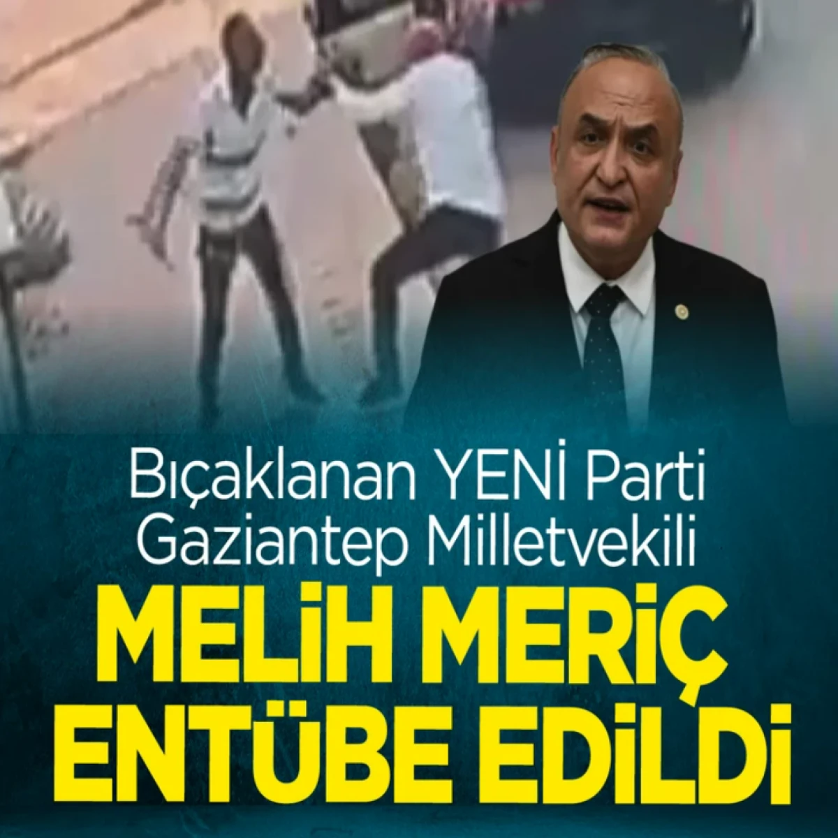 Bı&ccedil;aklı saldırıya uğrayan milletvekili Melih Meri&ccedil; ent&uuml;be edildi